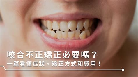 上下排牙齒平行|咬合不正怎麼辦？3分鐘認識咬合類型、症狀與矯正方。